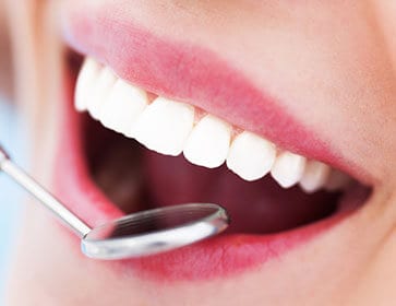 Hannibal Dental Group - periodontal treatment - periodontist near me - periodontal disease - gum disease treatment near me - dentist near me - Periodontists Hannibal, MO